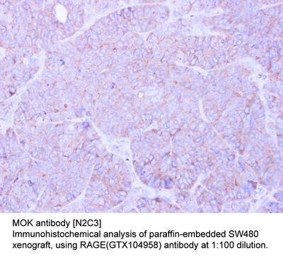 RAGE antibody [N2C3], GeneTex