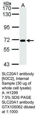 SLC20A1 antibody [N3C2], Internal, GeneTex