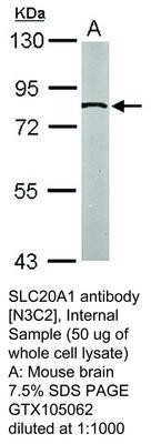 SLC20A1 antibody [N3C2], Internal, GeneTex