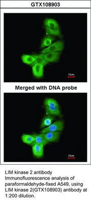 LIM kinase 2 antibody, GeneTex