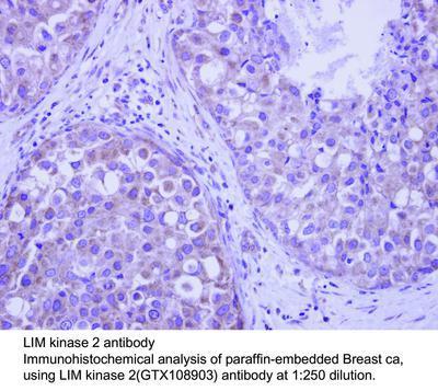 LIM kinase 2 antibody, GeneTex