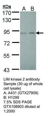 LIM kinase 2 antibody, GeneTex