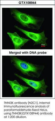 TNNI3K antibody [N2C1], Internal, GeneTex