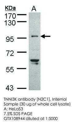 TNNI3K antibody [N2C1], Internal, GeneTex