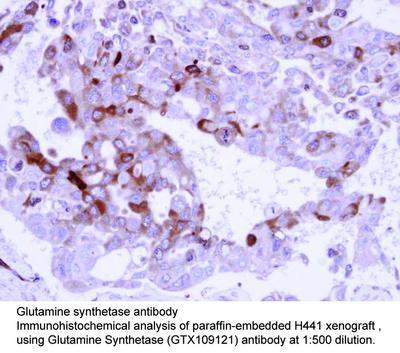 Glutamine synthetase antibody [N1C3], GeneTex