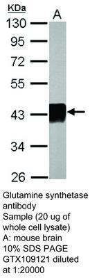 Glutamine synthetase antibody [N1C3], GeneTex