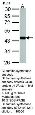 Glutamine synthetase antibody [N1C3], GeneTex