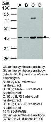 Glutamine synthetase antibody [N1C3], GeneTex