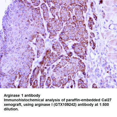 Arginase 1 antibody, GeneTex