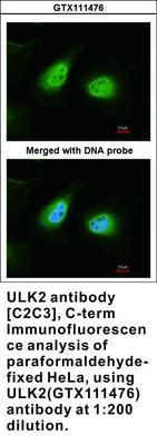 ULK2 antibody [C2C3], C-term, GeneTex