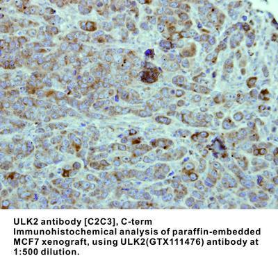 ULK2 antibody [C2C3], C-term, GeneTex