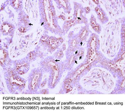 FGFR3 antibody [N3], Internal, GeneTex