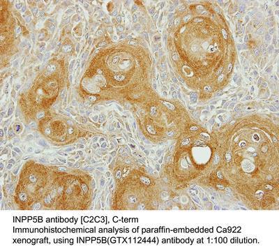 INPP5B antibody [C2C3], C-term, GeneTex