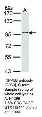 INPP5B antibody [C2C3], C-term, GeneTex