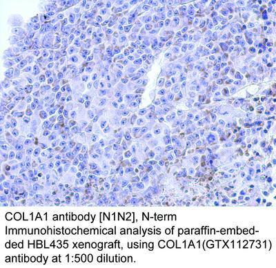 COL1A1 antibody [N1N2], N-term, GeneTex