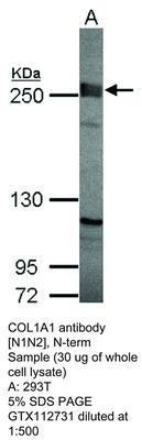 COL1A1 antibody [N1N2], N-term, GeneTex