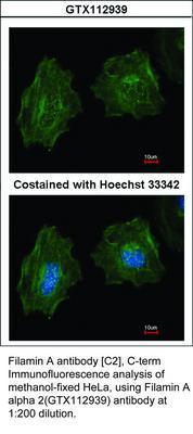 Filamin A antibody [C2], C-term, GeneTex