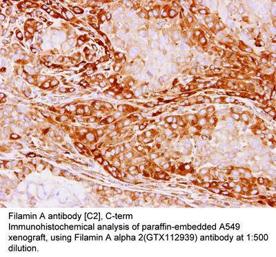 Filamin A antibody [C2], C-term, GeneTex