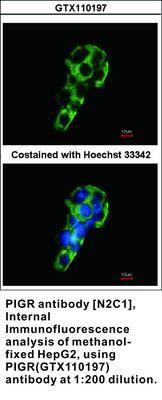 PIGR antibody [N2C1], Internal, GeneTex