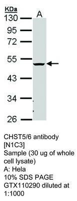 CHST5/6  antibody [N1C3], GeneTex