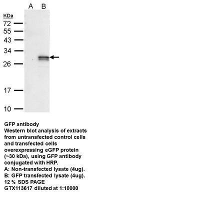 GFP antibody - Rabbit Polyclonal - ICC/IF, IHC-Wm, IP, WB - 100µl, GeneTex