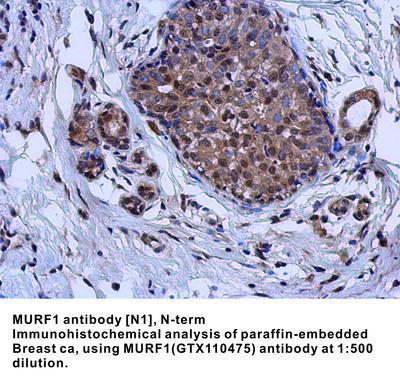 MURF1 antibody [N1], N-term, GeneTex