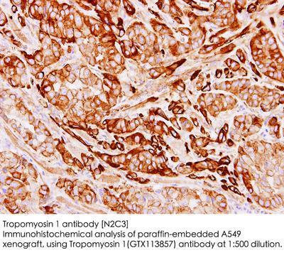 Tropomyosin 1 antibody [N2C3], GeneTex