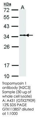 Tropomyosin 1 antibody [N2C3], GeneTex