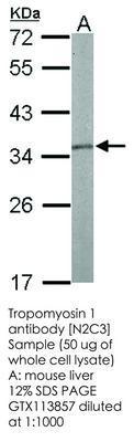 Tropomyosin 1 antibody [N2C3], GeneTex