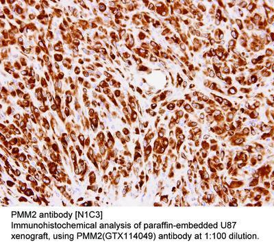 PMM2 antibody [N1C3], GeneTex