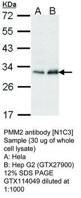 PMM2 antibody [N1C3], GeneTex