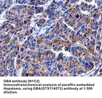 GBA antibody [N1C2], GeneTex