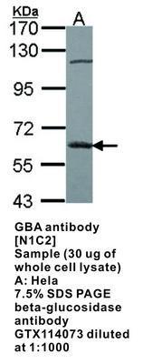 GBA antibody [N1C2], GeneTex