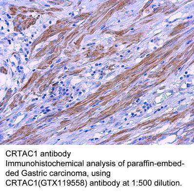 CRTAC1 antibody, GeneTex