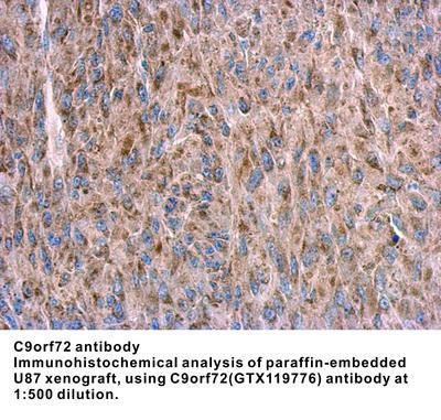 C9orf72 antibody, GeneTex