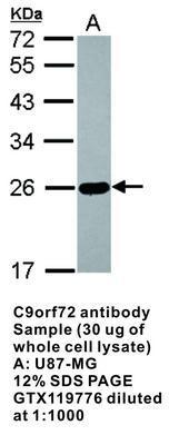 C9orf72 antibody, GeneTex