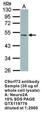 C9orf72 antibody, GeneTex