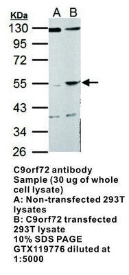 C9orf72 antibody, GeneTex