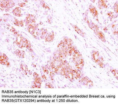 RAB35 antibody [N1C3], GeneTex