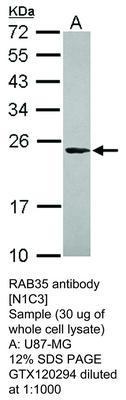 RAB35 antibody [N1C3], GeneTex